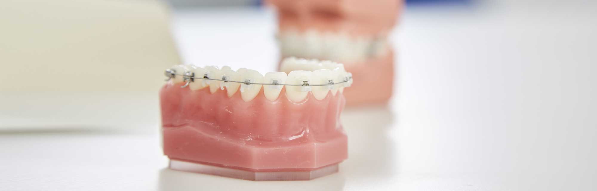 Kieferorthopädie Niendorf